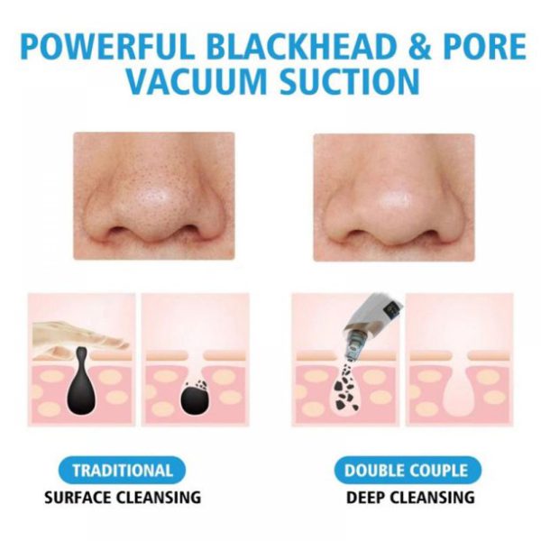 Blackhead Pore Cleaning